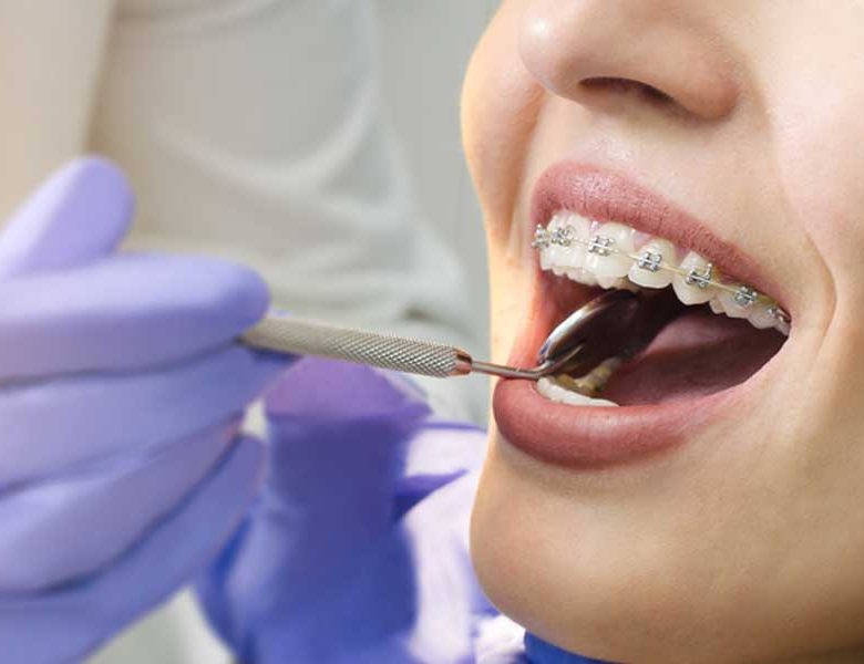 Sağlıklı Dişler İçin Eryaman Diş